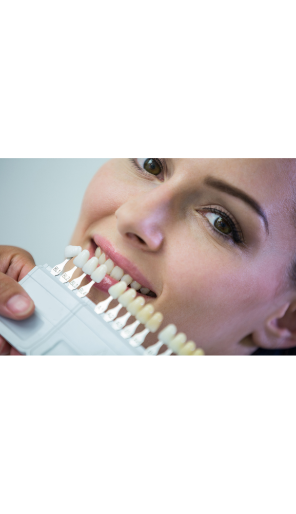 Lente de contato dental itajaia